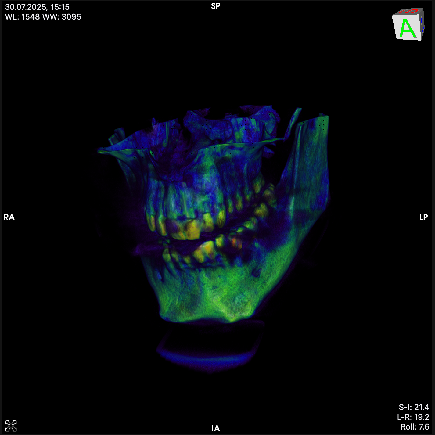 зубы мои зубы